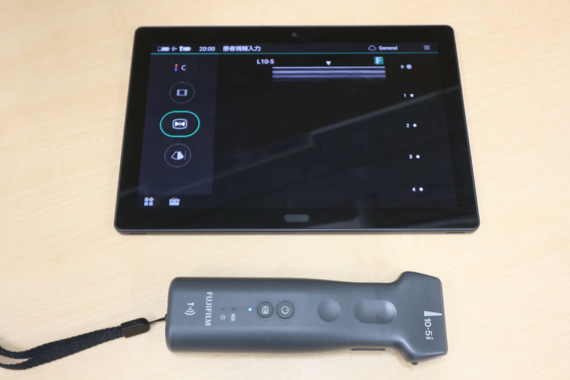 ポータブルエコー